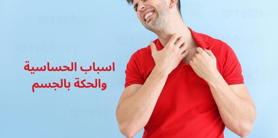 اسباب الحساسيه والحكه بالجسم