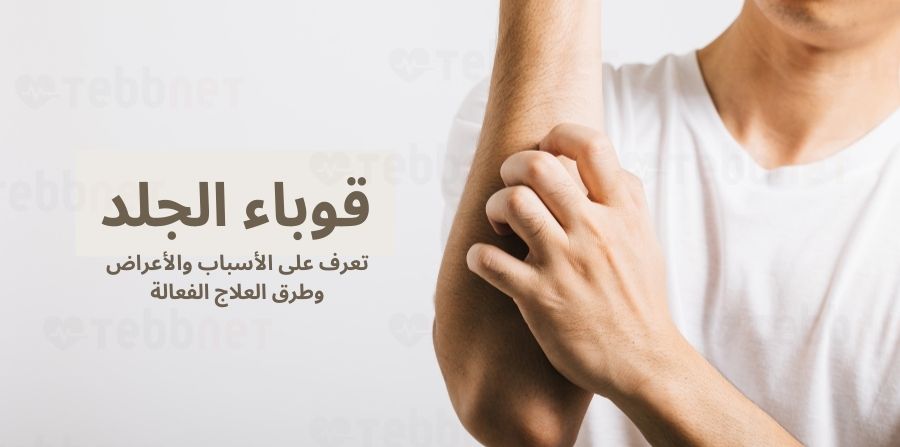 قوباء الجلد: الأسباب والأعراض وطرق العلاج الفعالة