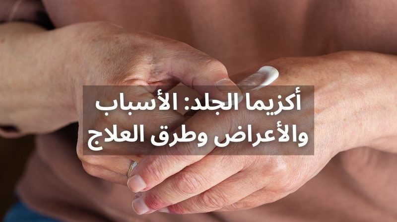 أكزيما الجلد: الأسباب والأعراض وطرق العلاج