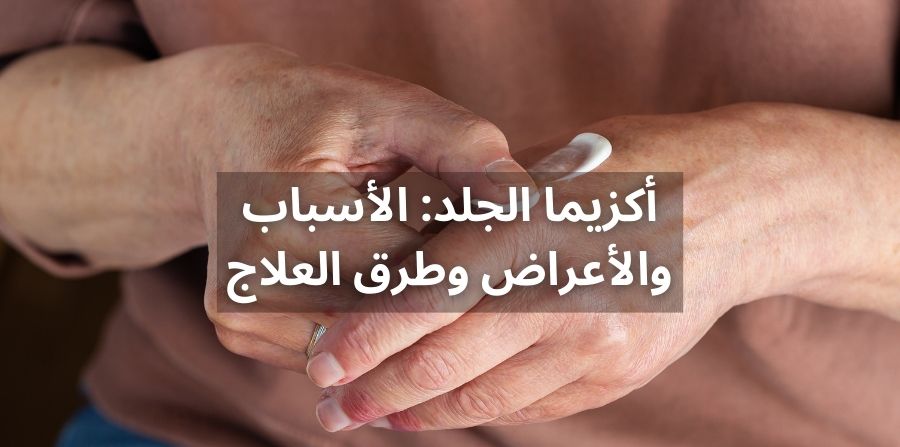 أكزيما الجلد: الأسباب والأعراض وطرق العلاج