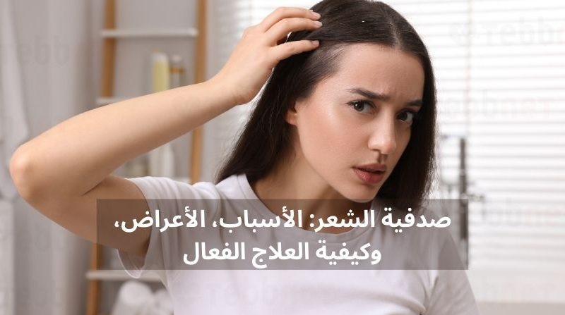 صدفية الشعر: الأسباب، الأعراض، وكيفية العلاج الفعال