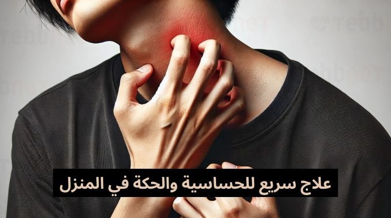 علاج سريع للحساسية والحكة في المنزل