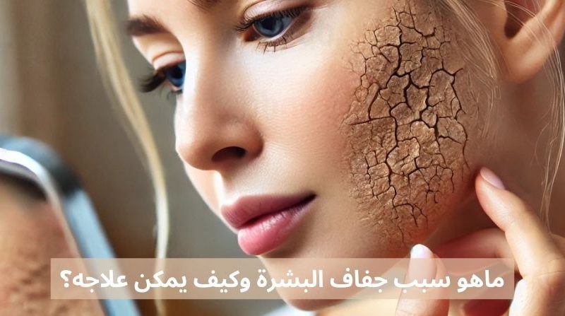 ماهو سبب جفاف البشرة وكيف يمكن علاجه؟